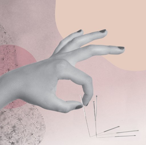 accupuncture